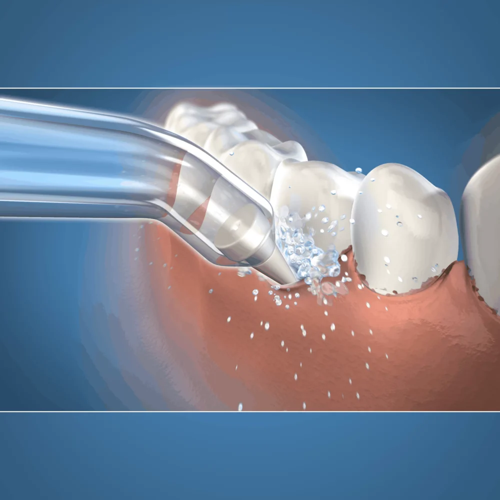 Waterpik antgaliukas Pik Pocket PP (2vnt.) - Image 2